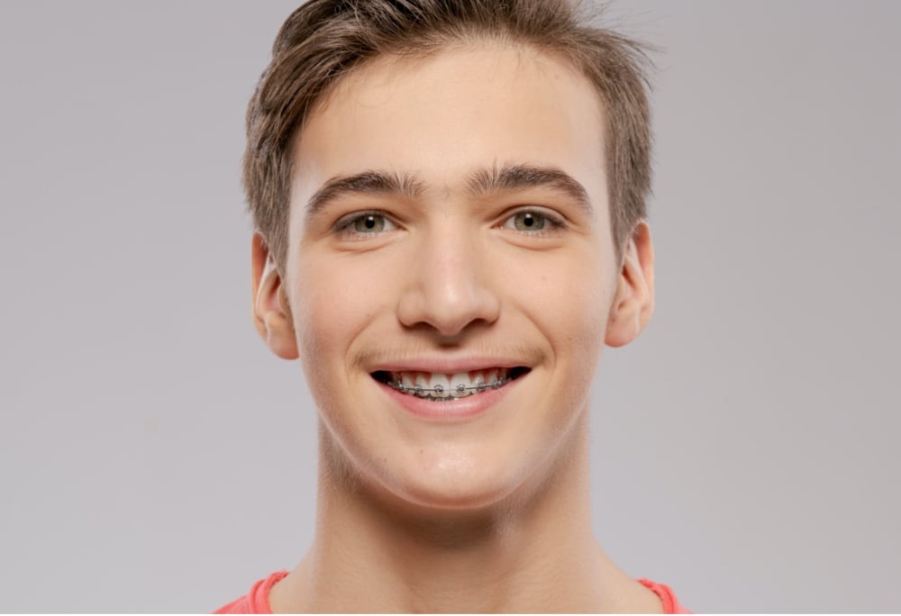 teen boy with metal braces smiling